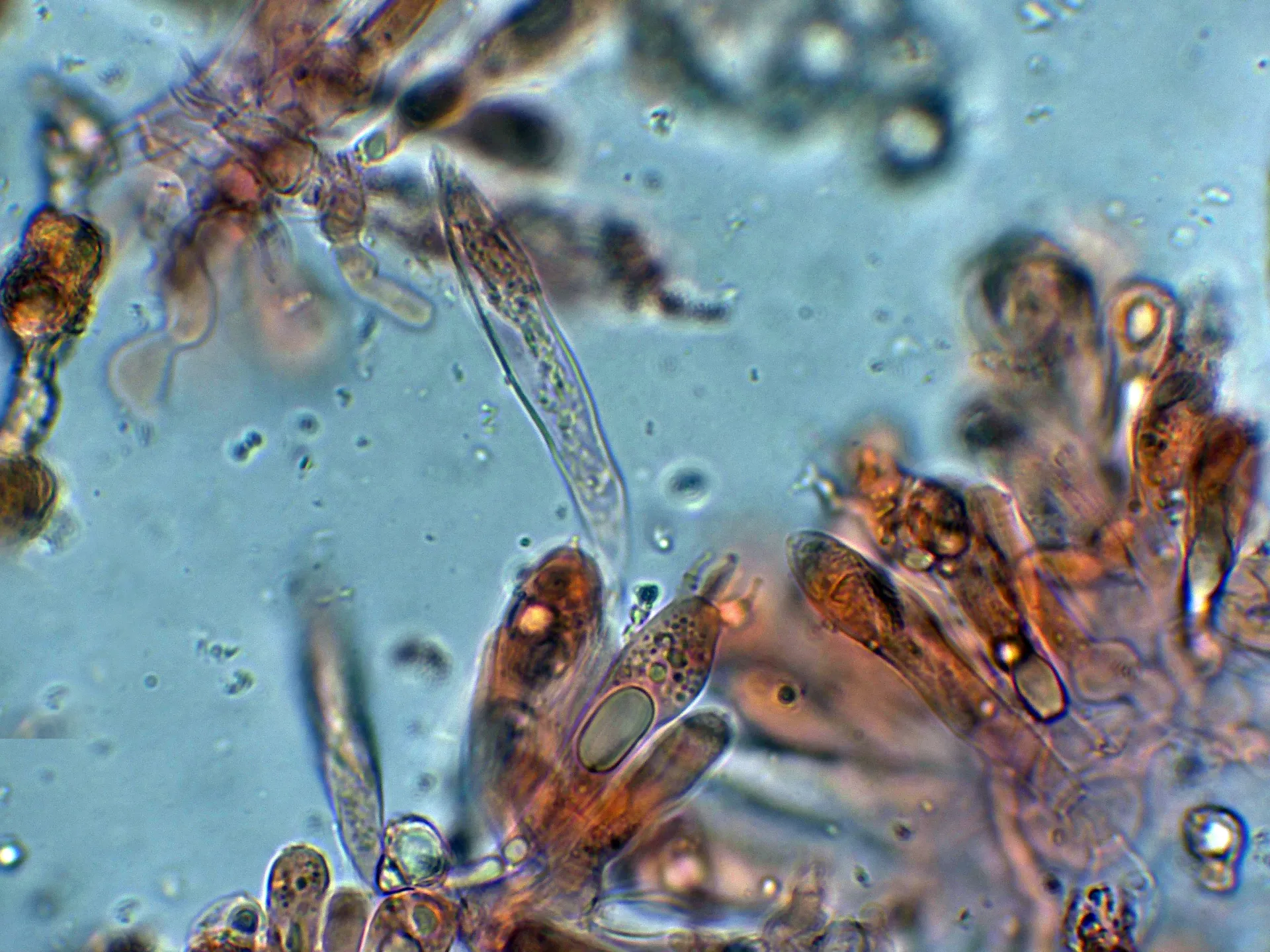 Microscopía de Russula fellea - 10 - Queiloistidio-001